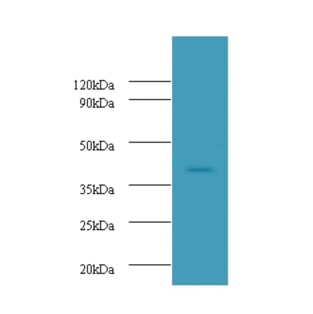 Ubiquitin-conjugating enzyme E2 Q2 Polyclonal Antibody from Signalway Antibody (42667) - Antibodies.com