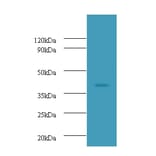 Ubiquitin-conjugating enzyme E2 Q2 Polyclonal Antibody from Signalway Antibody (42667) - Antibodies.com