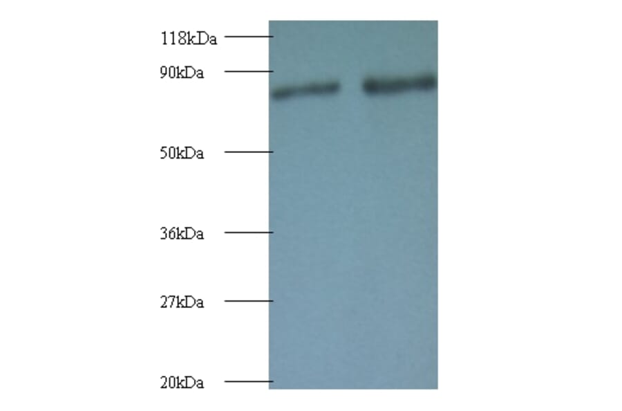 Ras-related protein Rab-1A Polyclonal Antibody from Signalway Antibody (42088) - Antibodies.com