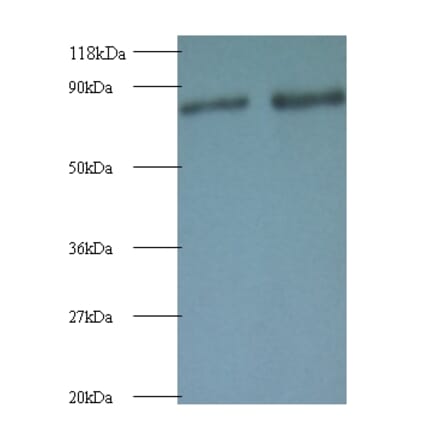 Ras-related protein Rab-1A Polyclonal Antibody from Signalway Antibody (42088) - Antibodies.com