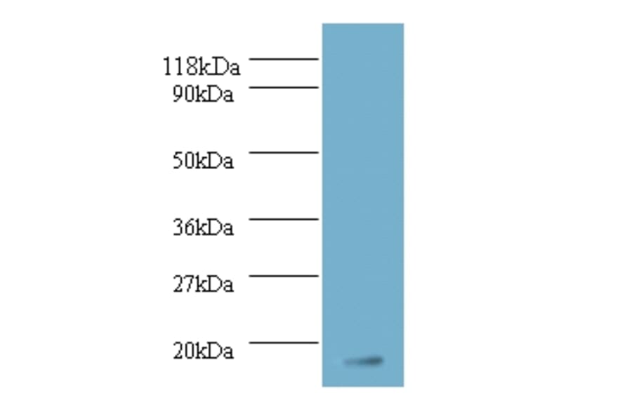 Fibroblast growth factor 1 Polyclonal Antibody from Signalway Antibody (42169) - Antibodies.com
