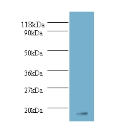 Fibroblast growth factor 1 Polyclonal Antibody from Signalway Antibody (42169) - Antibodies.com