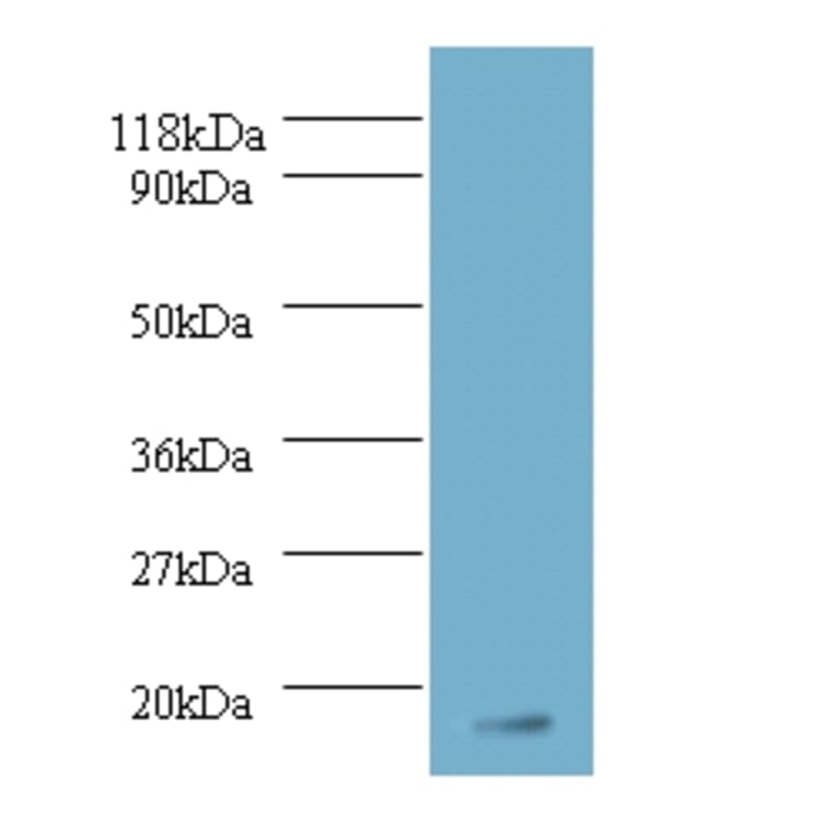 Fibroblast growth factor 1 Polyclonal Antibody from Signalway Antibody (42169) - Antibodies.com