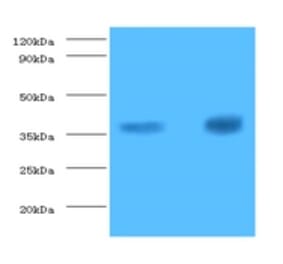 Troponin T, cardiac muscle Polyclonal Antibody from Signalway Antibody (42519) - Antibodies.com