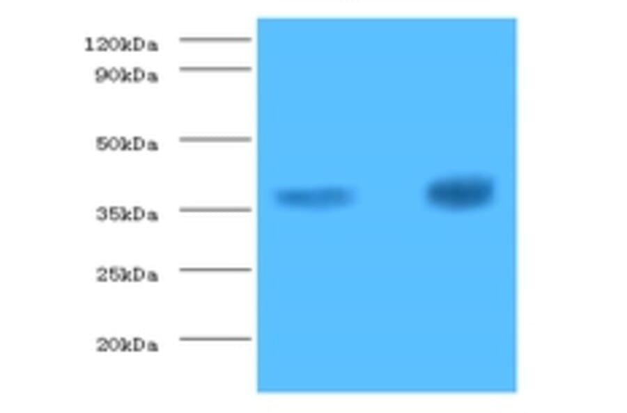 Troponin T, cardiac muscle Polyclonal Antibody from Signalway Antibody (42519) - Antibodies.com
