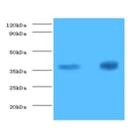 Troponin T, cardiac muscle Polyclonal Antibody from Signalway Antibody (42519) - Antibodies.com