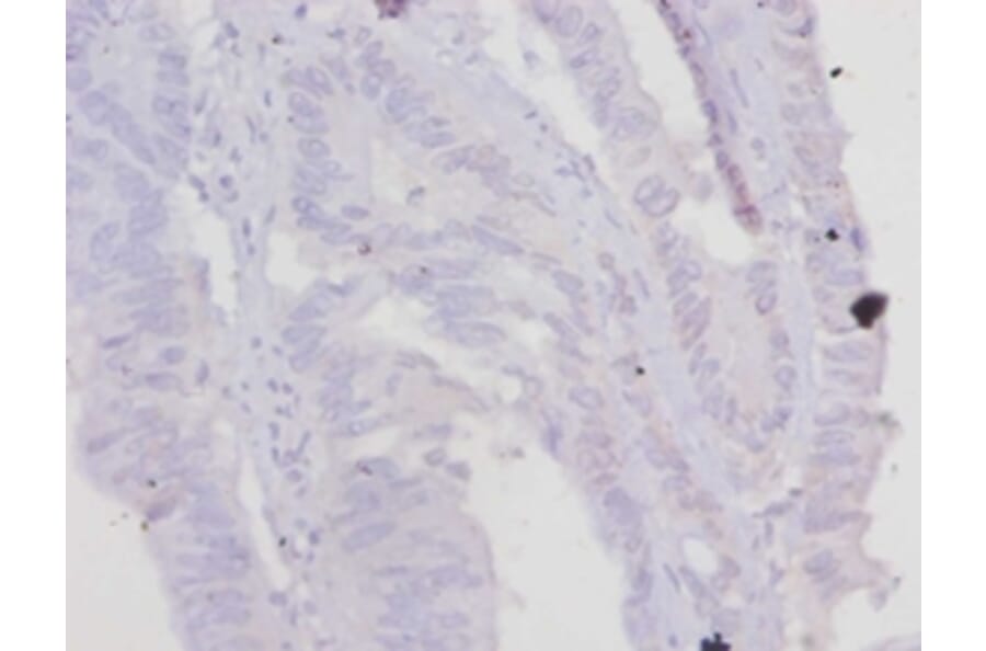 Immunohistochemistry - Troponin T, cardiac muscle Polyclonal Antibody from Signalway Antibody - Antibodies.com