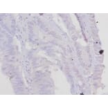 Immunohistochemistry - Troponin T, cardiac muscle Polyclonal Antibody from Signalway Antibody - Antibodies.com