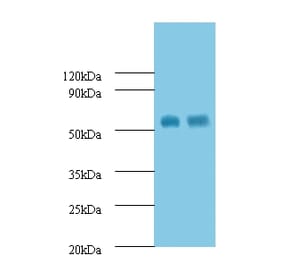 Macrophage metalloelastase Polyclonal Antibody from Signalway Antibody (42560) - Antibodies.com