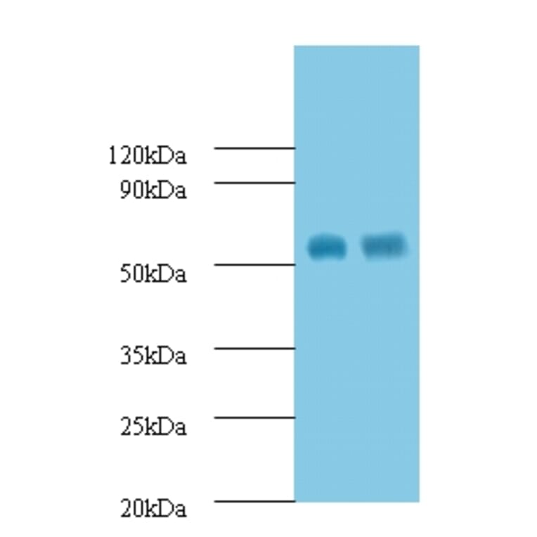 Macrophage metalloelastase Polyclonal Antibody from Signalway Antibody (42560) - Antibodies.com