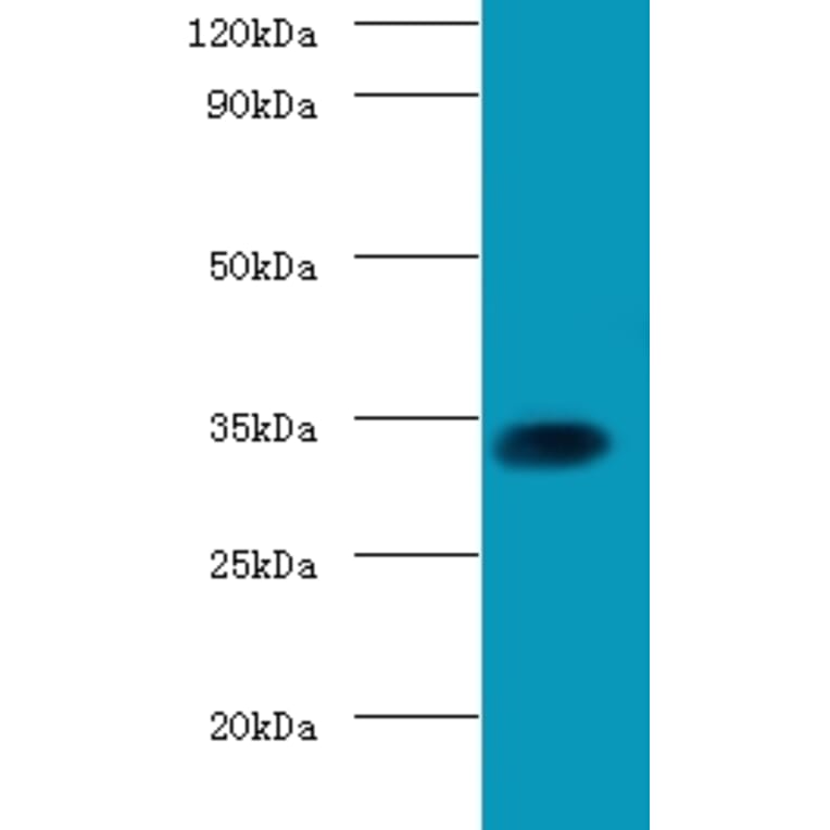 Transcription factor SOX-2 Polyclonal Antibody from Signalway Antibody (42604) - Antibodies.com