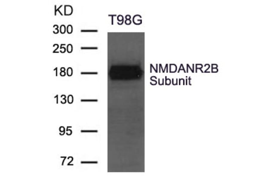 Western blot - NMDANR2B Subunit Antibody from Signalway Antibody (21560) - Antibodies.com