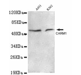 CARM1 Monoclonal Antibody from Signalway Antibody (27011) - Antibodies.com
