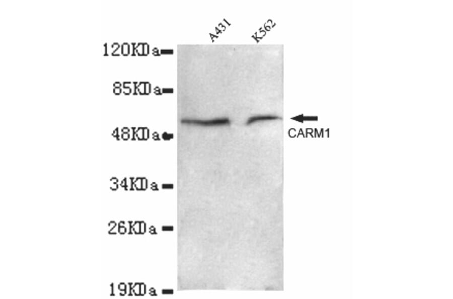 CARM1 Monoclonal Antibody from Signalway Antibody (27011) - Antibodies.com