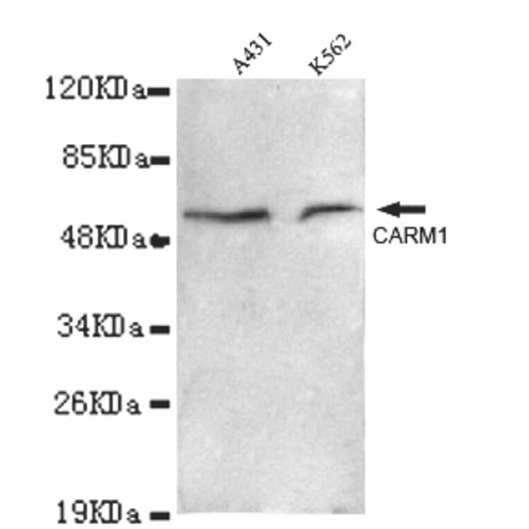 CARM1 Monoclonal Antibody from Signalway Antibody (27011) - Antibodies.com