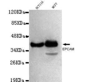 EPCAM Monoclonal Antibody from Signalway Antibody (27030) - Antibodies.com