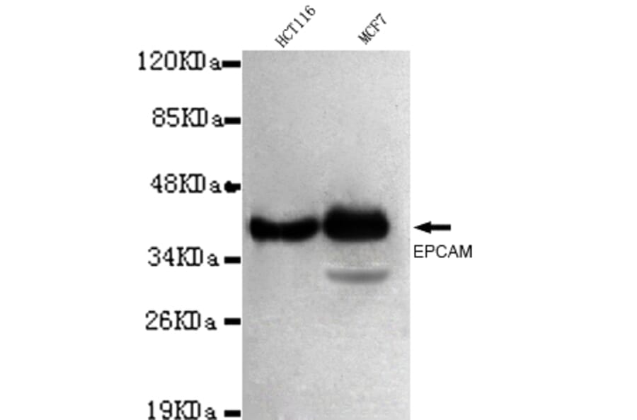 EPCAM Monoclonal Antibody from Signalway Antibody (27030) - Antibodies.com