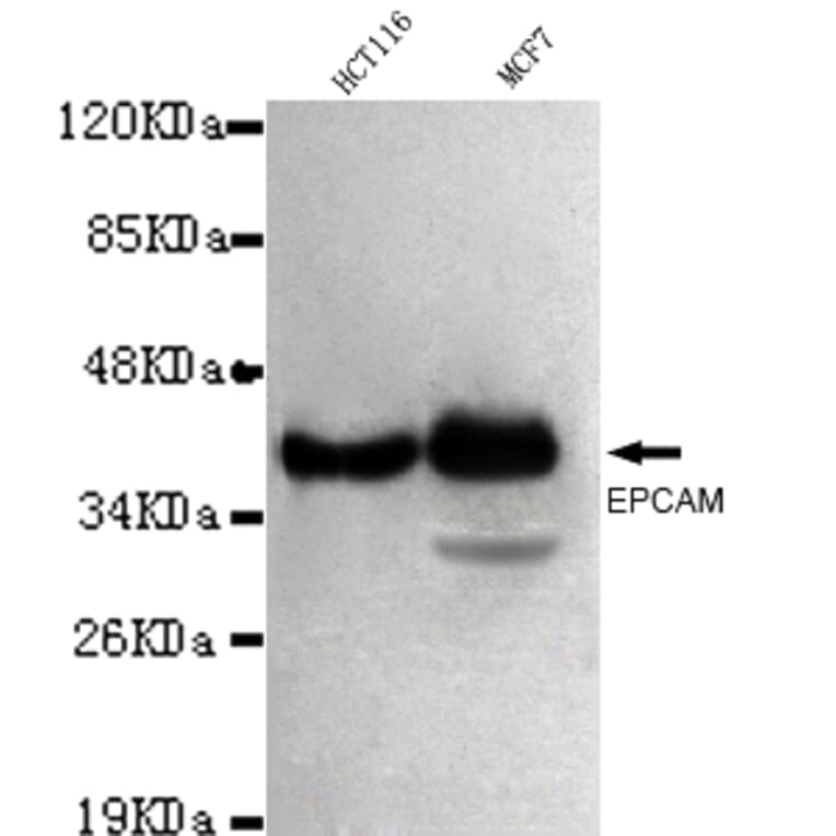 EPCAM Monoclonal Antibody from Signalway Antibody (27030) - Antibodies.com
