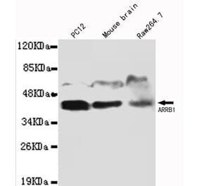 ARRB1 Monoclonal Antibody from Signalway Antibody (27077) - Antibodies.com