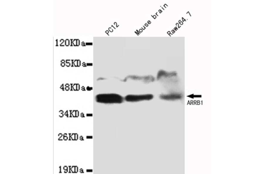 ARRB1 Monoclonal Antibody from Signalway Antibody (27077) - Antibodies.com