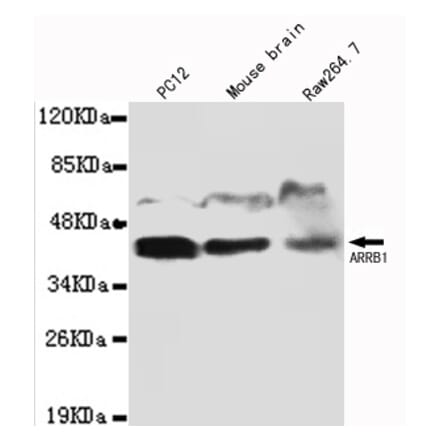 ARRB1 Monoclonal Antibody from Signalway Antibody (27077) - Antibodies.com
