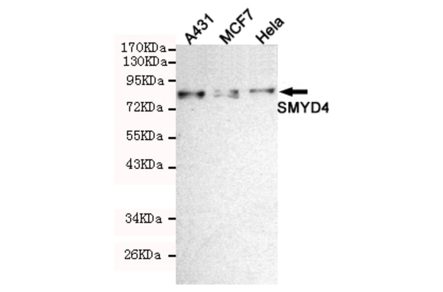 Western blot - SMYD4 Monoclonal Antibody from Signalway Antibody (27215) - Antibodies.com