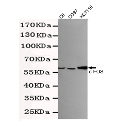 Western blot - c-Fos Monoclonal Antibody from Signalway Antibody (27217) - Antibodies.com