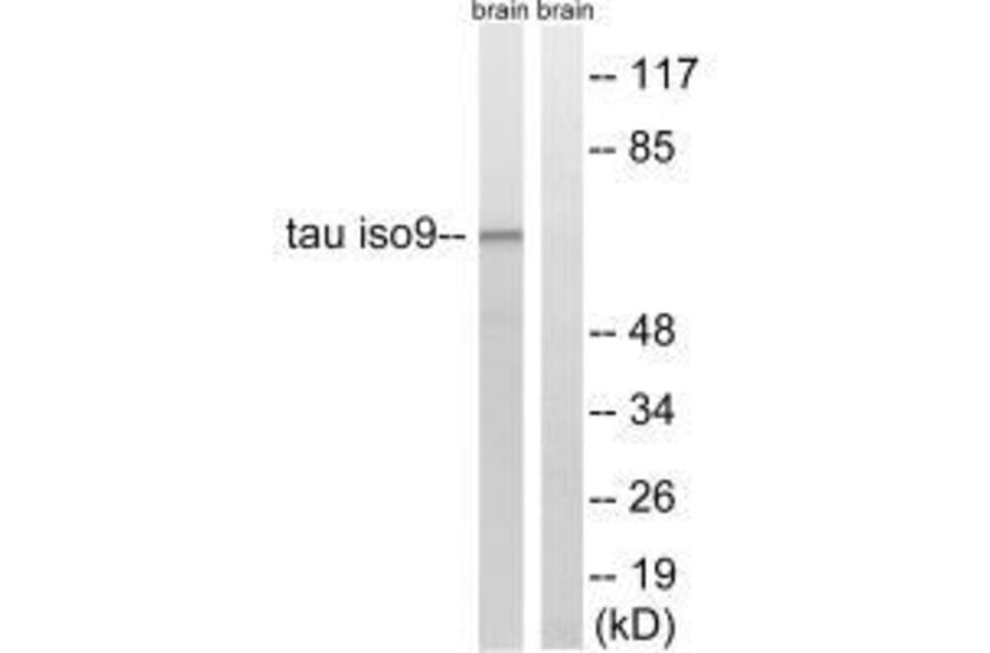 Western blot - Tau (Ab-534/217) Antibody from Signalway Antibody (33222) - Antibodies.com