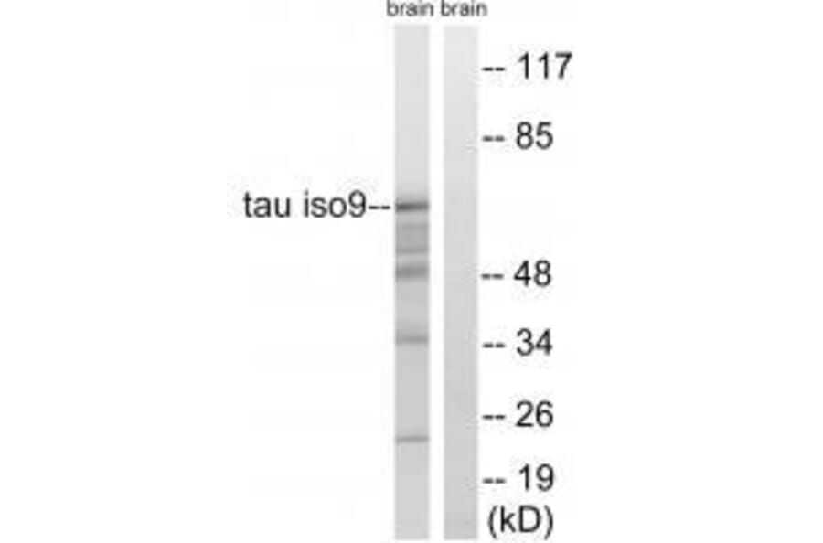 Western blot - Tau (Ab-717/400) Antibody from Signalway Antibody (33223) - Antibodies.com