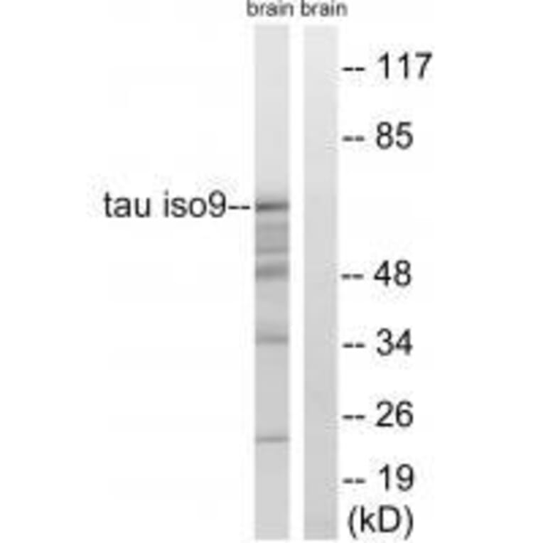 Western blot - Tau (Ab-717/400) Antibody from Signalway Antibody (33223) - Antibodies.com