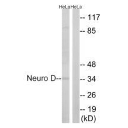 Western blot - Neuro D (Ab-274) Antibody from Signalway Antibody (33290) - Antibodies.com