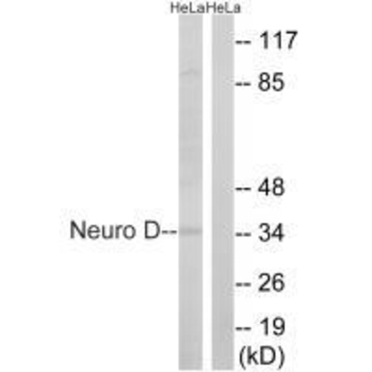Western blot - Neuro D (Ab-274) Antibody from Signalway Antibody (33290) - Antibodies.com