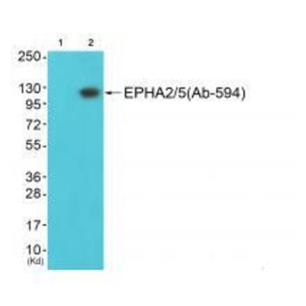 Western blot - EPHA2/5 (Ab-594) Antibody from Signalway Antibody (33309) - Antibodies.com