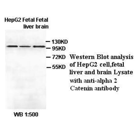 alpha 2 Catenin Antibody from Signalway Antibody (39412) - Antibodies.com