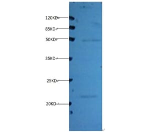 Timp1 Monoclonal Antibody from Signalway Antibody (42030) - Antibodies.com