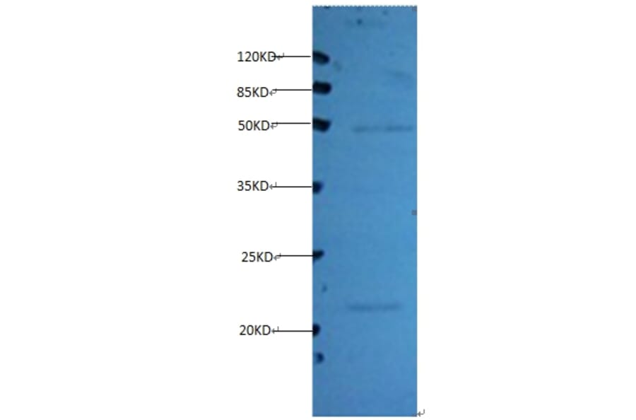 Timp1 Monoclonal Antibody from Signalway Antibody (42030) - Antibodies.com