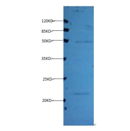 Timp1 Monoclonal Antibody from Signalway Antibody (42030) - Antibodies.com