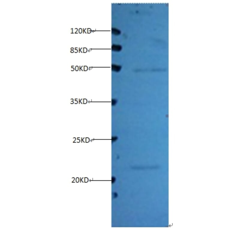 Timp1 Monoclonal Antibody from Signalway Antibody (42030) - Antibodies.com