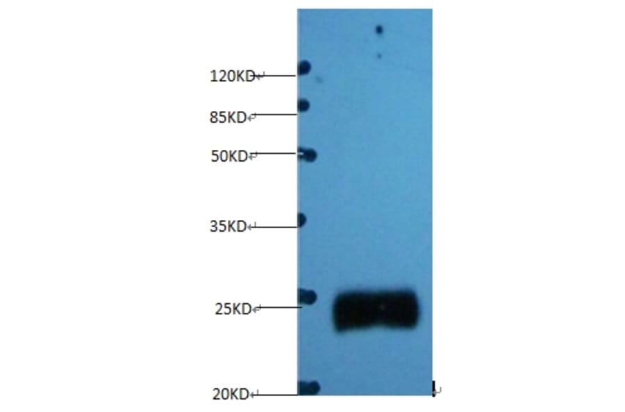 Timp1 Monoclonal Antibody from Signalway Antibody (42030) - Antibodies.com