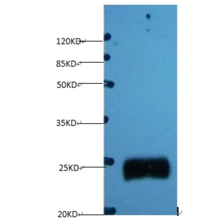 Timp1 Monoclonal Antibody from Signalway Antibody (42030) - Antibodies.com