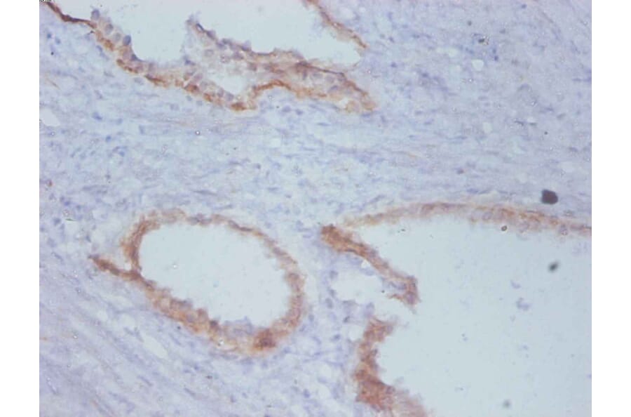 Immunohistochemistry - Timp1 Monoclonal Antibody from Signalway Antibody (42030) - Antibodies.com