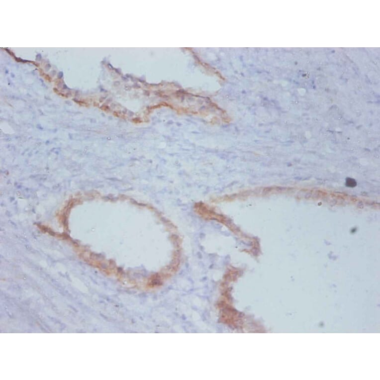 Immunohistochemistry - Timp1 Monoclonal Antibody from Signalway Antibody (42030) - Antibodies.com