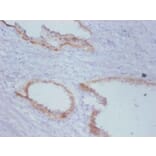 Immunohistochemistry - Timp1 Monoclonal Antibody from Signalway Antibody (42030) - Antibodies.com