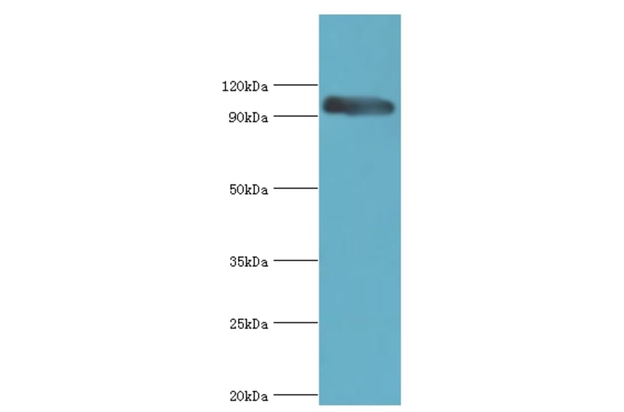 CAPN3 Polyclonal Antibody from Signalway Antibody (42100) - Antibodies.com