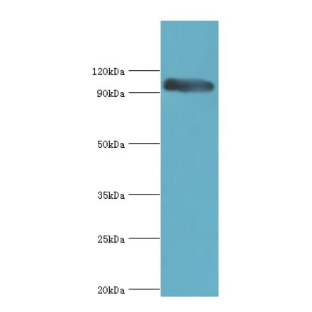 CAPN3 Polyclonal Antibody from Signalway Antibody (42100) - Antibodies.com