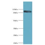 CAPN3 Polyclonal Antibody from Signalway Antibody (42100) - Antibodies.com