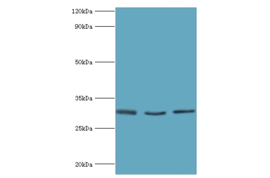 KITLG Polyclonal Antibody from Signalway Antibody (42231) - Antibodies.com