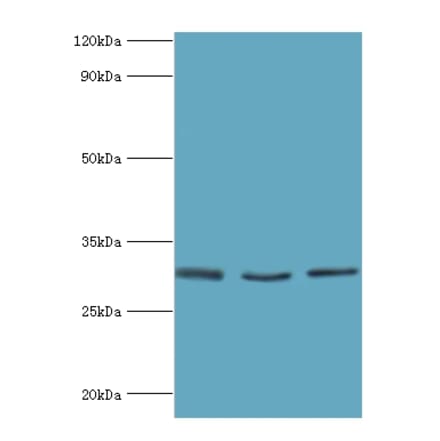 KITLG Polyclonal Antibody from Signalway Antibody (42231) - Antibodies.com