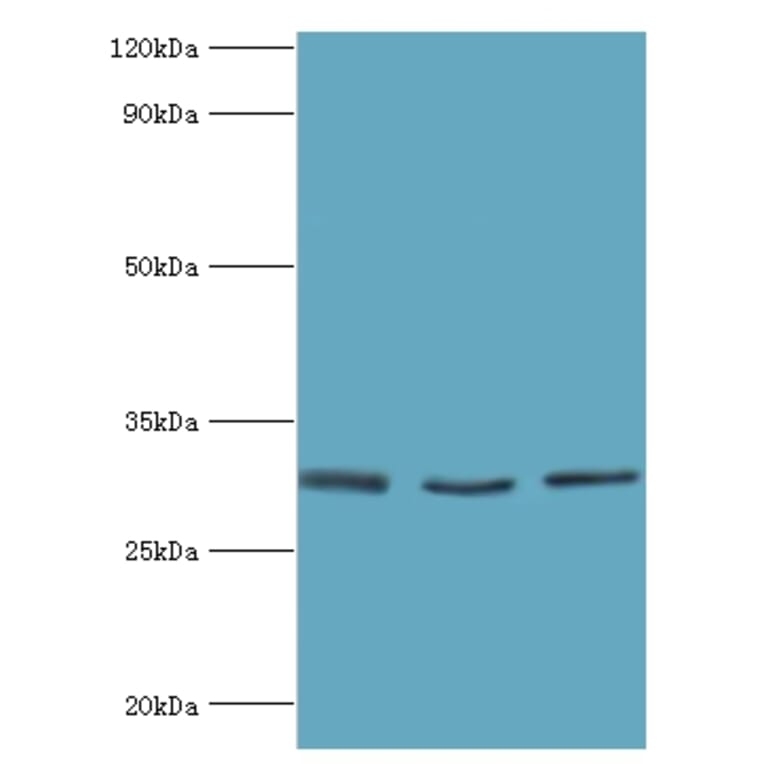 KITLG Polyclonal Antibody from Signalway Antibody (42231) - Antibodies.com