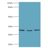 KITLG Polyclonal Antibody from Signalway Antibody (42231) - Antibodies.com